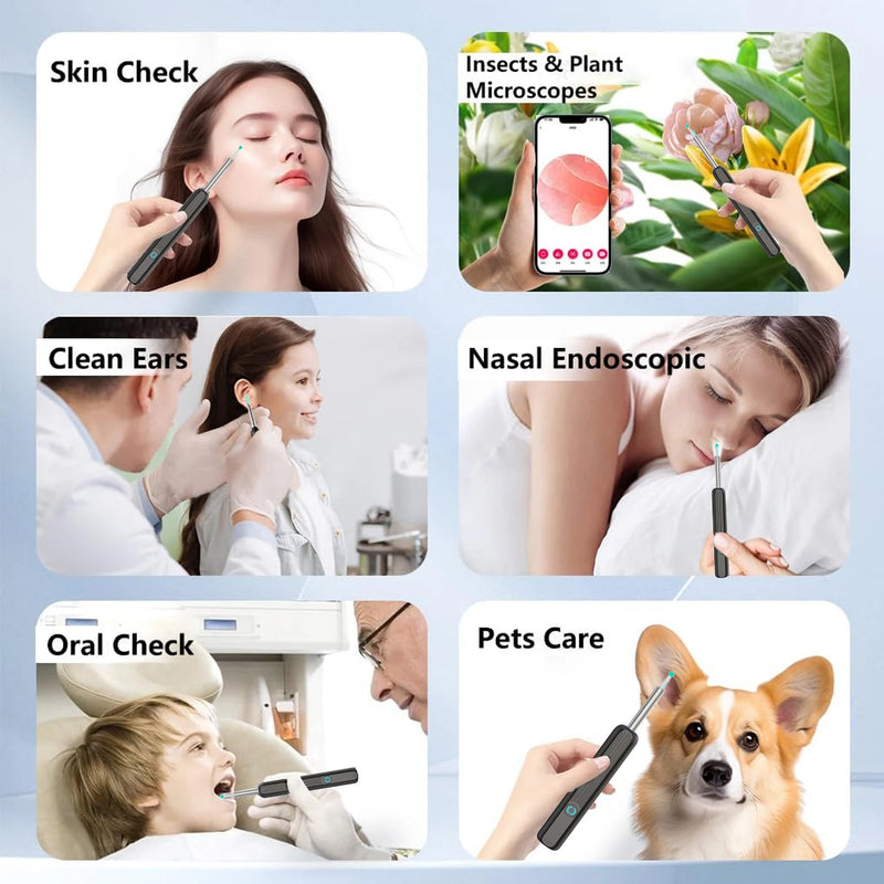 ឧបករណ៍សម្អាតត្រចៀក Smart Visual HD ដំបងត្រចៀក Otoscope USB C សាកថ្ម ឧបករណ៍ Endoscope ដកយកក្រមួនចេញ ឧបករណ៍ចាក់ត្រចៀក កាមេរ៉ាខ្នាតតូច ឈុតថែទាំសុខភាព